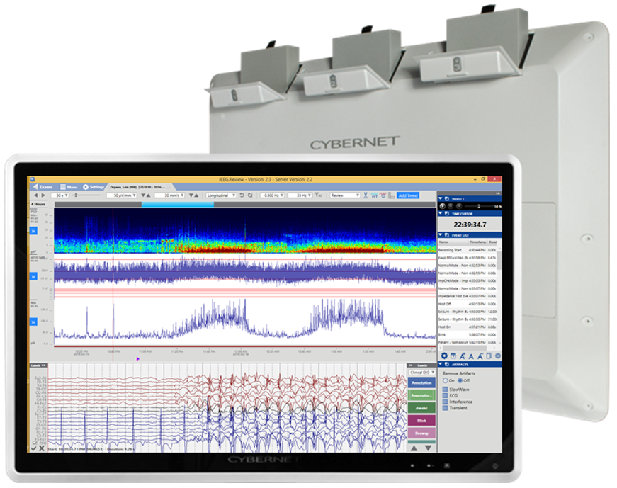 StratusEEG ICU/NICU www.Cephalon.eu