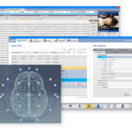 Stratus EEG